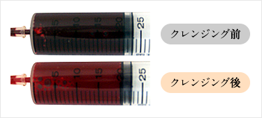 アンチエイジング点滴