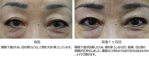 症例1