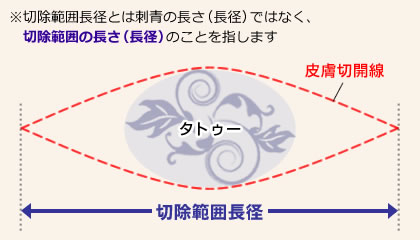 除去範囲